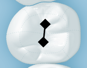 Kuva7.png
