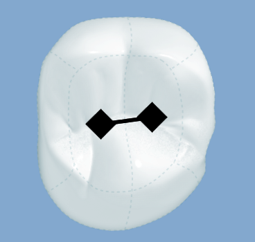 Snag_e45e76.png