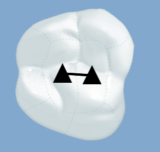 Snag_e56334.png