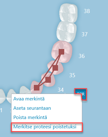 merkitse_proteesi_poistetuksi.png