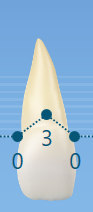 paro2.png